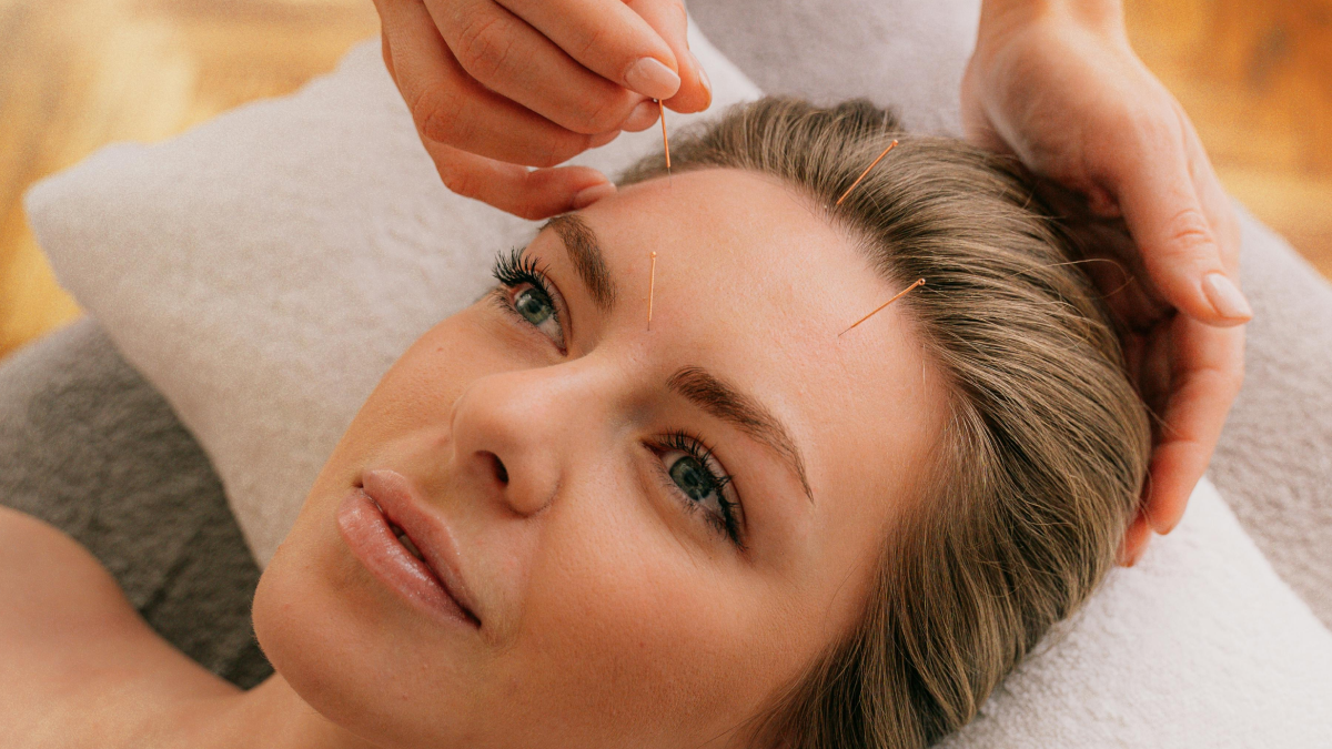 Acupuncture du visage : tout savoir sur cette technique et ses ...