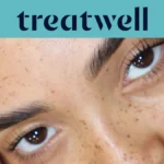 Bannière Treatwell turquoise avec un gros plan sur des cils naturellement rehaussés après un rehaussement de cils coréen, sur une peau constellée de taches de rousseur